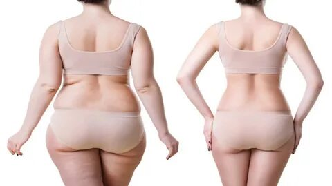 Liposuction in NYC: Sculpt Your Body with Confidence