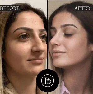 How to Choose the Best Plastic Surgeons in Dubai for Your Procedure