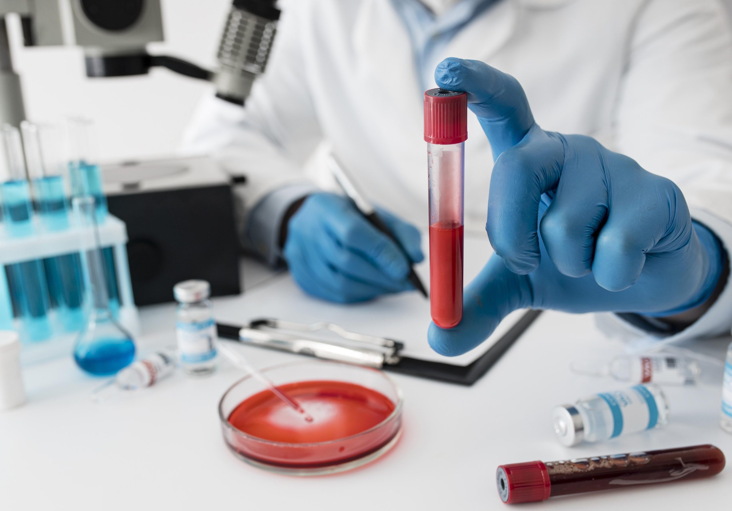 Blood Test in Bangalore