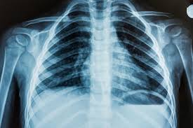 Nearest X Ray Lab